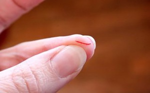 Một phụ nữ tử vong chỉ vì một vết xước nhỏ trên tay