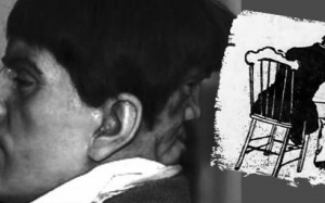 Khuôn mặt ma quái sau gáy người đàn ông khiến y học bối rối