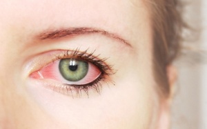 Hà Nội: Lại tái xuất nguy cơ cả nhà đau mắt đỏ