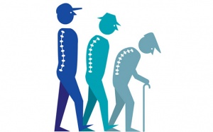 Lùn đi khi già nguy hiểm hơn tưởng tượng