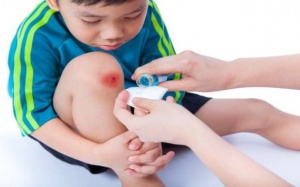 Vì sao bạn không nên dùng rượu để làm sạch vết thương?