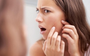 4 căn bệnh tinh thần ở những người bị mụn trứng cá