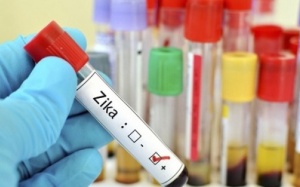 Bé gái 4 tuổi ở Long An nhiễm virus Zika