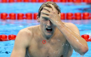 Xem hình, độc giả chẩn đoán nhà vô địch Olympic bị ung thư