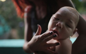Bệnh đầu nhỏ do Zika chỉ phát hiện vào cuối thai kỳ