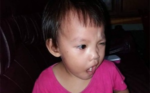 Mẹ tá hỏa phát hiện con bị méo miệng, liệt mặt chỉ sau 1 đêm trời trở gió