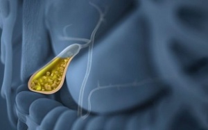 Bệnh túi mật: Chẩn đoán và điều trị thế nào?