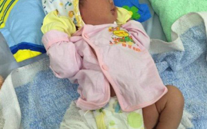 Bác sỹ mổ lấy thai, một bé sơ sinh bị gãy xương đùi