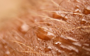 Đổ mồ hôi quá mức có thể là dấu hiệu của nhiều bệnh