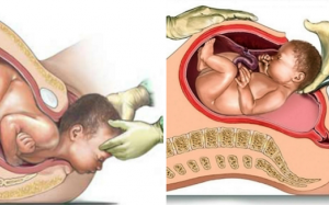 Sinh thường và sinh mổ: So sánh lợi ích, tác hại giúp mẹ thêm vững tin