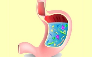 Khi nào mẹ nên cho trẻ dùng men vi sinh?