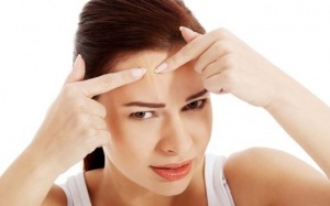 Điều trị mụn ở trán bằng nguyên liệu tự nhiên