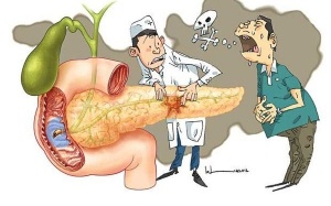 6 triệu chứng thường gặp của bệnh ung thư tuyến tụy