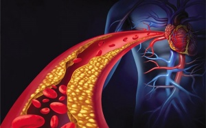 Hãy xóa nỗi ám ảnh về cholesterol
