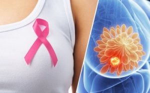 Những dấu hiệu bệnh ung thư vú ít khi được chú ý