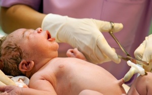 Mẹ cần nhớ: Cắt rốn chậm 1 phút, con thêm khỏe!