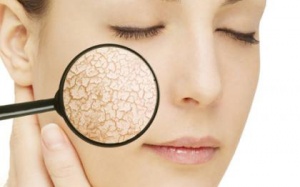 Da khô, bong tróc vào mùa Đông phải làm sao?