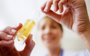 Nước tiểu đục là mắc bệnh gì?