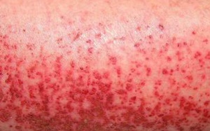 Sự trùng hợp nguy hiểm