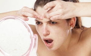 10 nguyên tắc mà các nàng da mụn đừng bao giờ quên