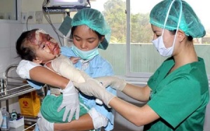 Xử lý đúng cách khi trẻ bị bỏng nước sôi