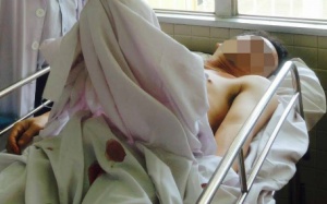 Nối thành công dương vật cho chàng trai tự hoại cơ thể