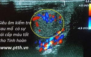 Việt Nam lần đầu nối ghép thành công hai tinh hoàn đứt rời cùng dương vật