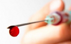 Lưu ý khi hiến máu và truyền máu để tránh HIV