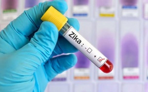 Có thể phòng Zika qua truyền máu được không?