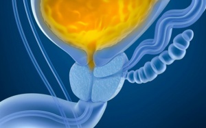 Nước tiểu đục cảnh báo bệnh gì?