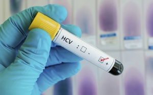 Xét nghiệm viêm gan C được WHO thông qua mang lại hy vọng cho người bệnh