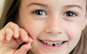 Răng vĩnh viễn mọc nhưng răng sữa vẫn chưa rụng phải làm sao?