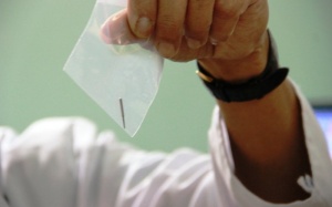 Đi làm răng, nuốt phải... mũi khoan của nha sỹ