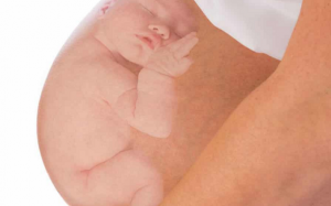 Thai ngôi mông: Mẹ phải làm gì để sinh con an toàn? 