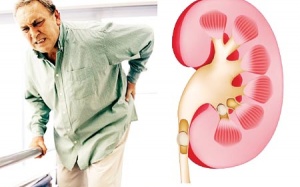 Ăn uống thế nào giúp ngăn ngừa suy thận?