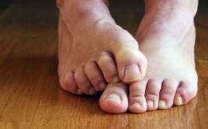 Làm gì khi bị hôi chân?