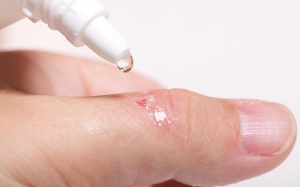 5 lợi ích đáng ngạc nhiên của Hydrogen Peroxide