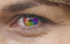 Bị bệnh mù màu chữa như thế nào?