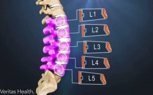 Kinh nghiệm đối phó với thoát vị đĩa đệm cột sống thắt lưng của một cựu chiến binh