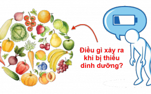 4 dấu hiệu cho thấy bạn bị thiếu vitamin và khoáng chất