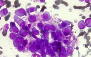 Thiết bị phát hiện 17 bệnh khác nhau chỉ bằng hơi thở bệnh nhân