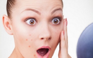 Trị mụn nhanh chóng hiệu quả nhất bằng những cách tự nhiên 