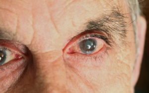 Gian nan tìm lại ánh sáng cho đôi mắt tuổi già