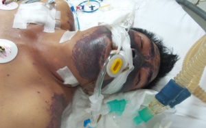 Dễ mắc bệnh chết người dịp Tết vì những hiểu lầm này