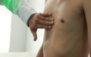 Lõm ngực bẩm sinh điều trị thế nào?