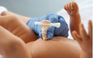 Bé sơ sinh tử vong vì uốn ván do cắt dây rốn bằng cật nứa