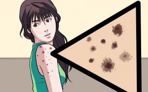 Có những loài vi khuẩn nào đang trú ẩn trong da của bạn?