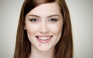 5 loại thực phẩm là nguyên nhân gây ra mụn trứng cá