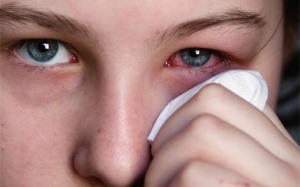 3 bệnh dị ứng ở mắt gây suy giảm thị lực