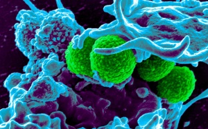 Đã tìm ra cách tiêu diệt vi khuẩn kháng thuốc chưa từng biết tới